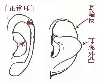 反廓耳|面相深论之“耳朵”系列—01